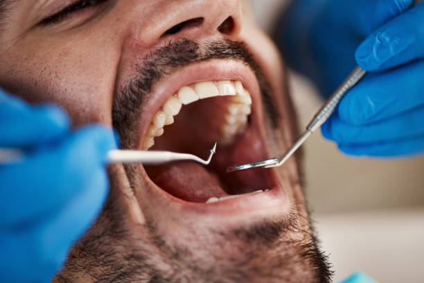 Best Urgent Tooth Repair  in Hiram, OH
